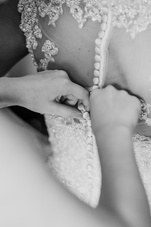ButtoningDress